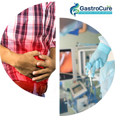 Gastrocure - clinicspotsdigitalservices.com Gastrocure