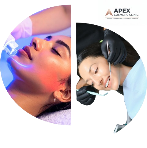 Apex-Cosmetic-Clinic